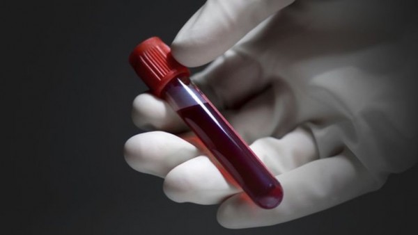 Анализ крови на паразитов: какие методи существуют