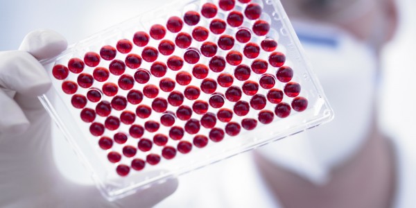 Анализ крови на антитела при гельминтозе