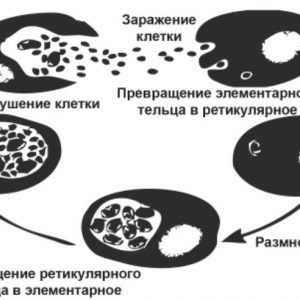 хламидиоз