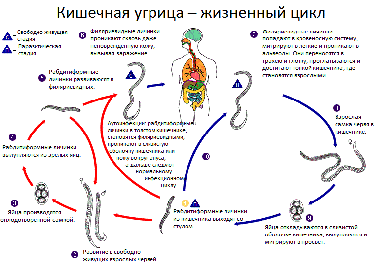Стронгилоидоз